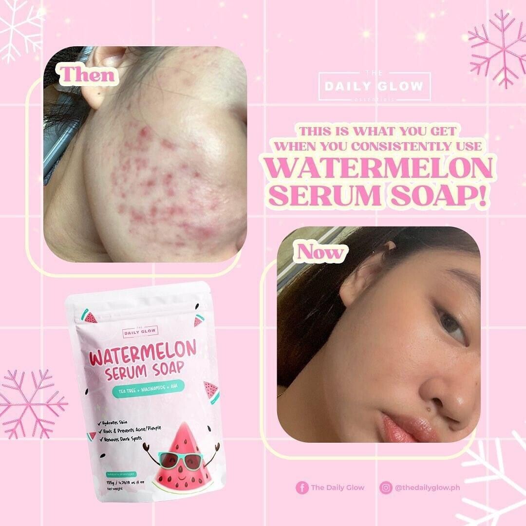 Watermelon Serum Soap 135g